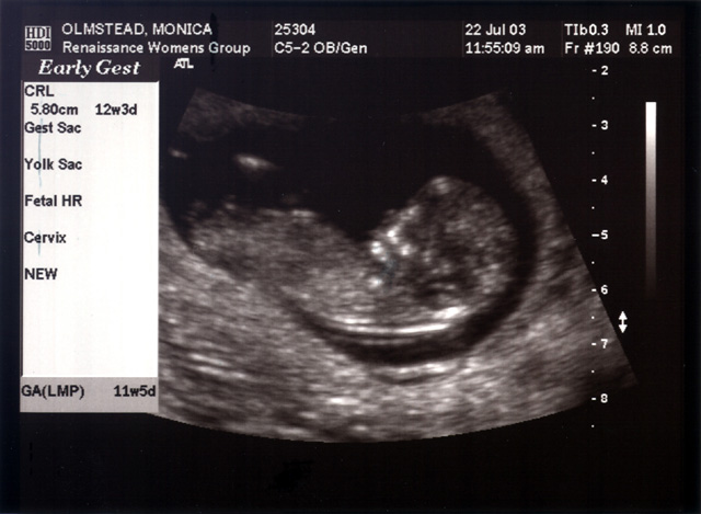 Baby Mojo
